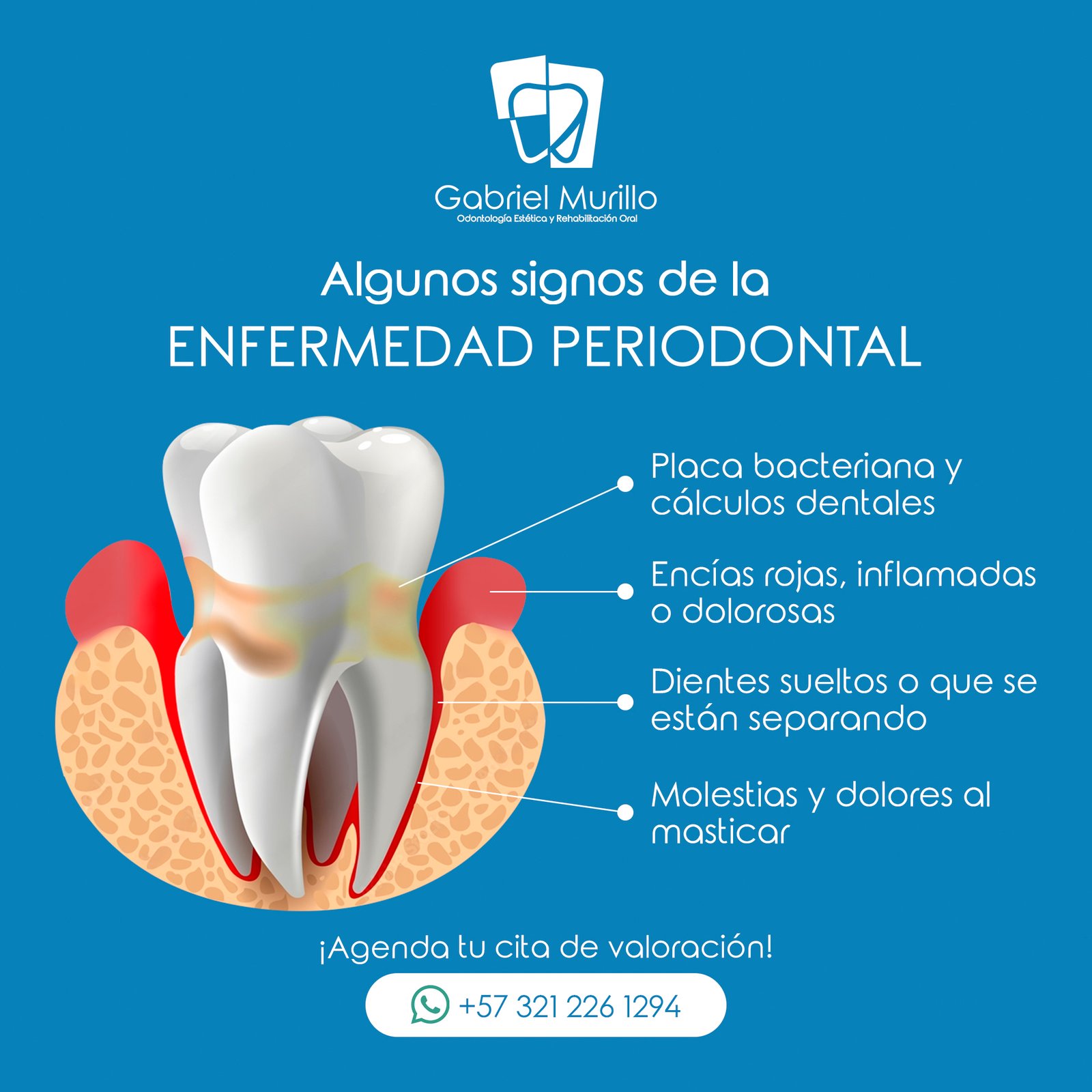 Gabriel Murillo - Mayo - Post 03 - Algunos signos de una enfermedad periodontal